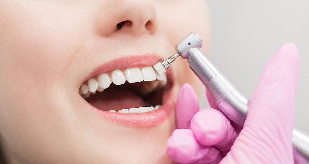 Tandblekning hos tandläkare